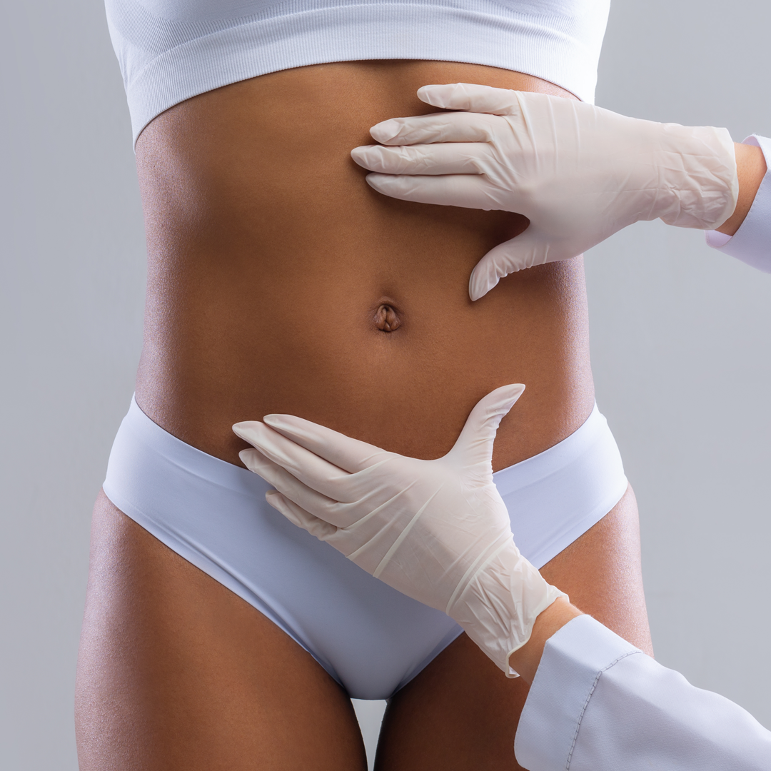 Liposuction Surgery
