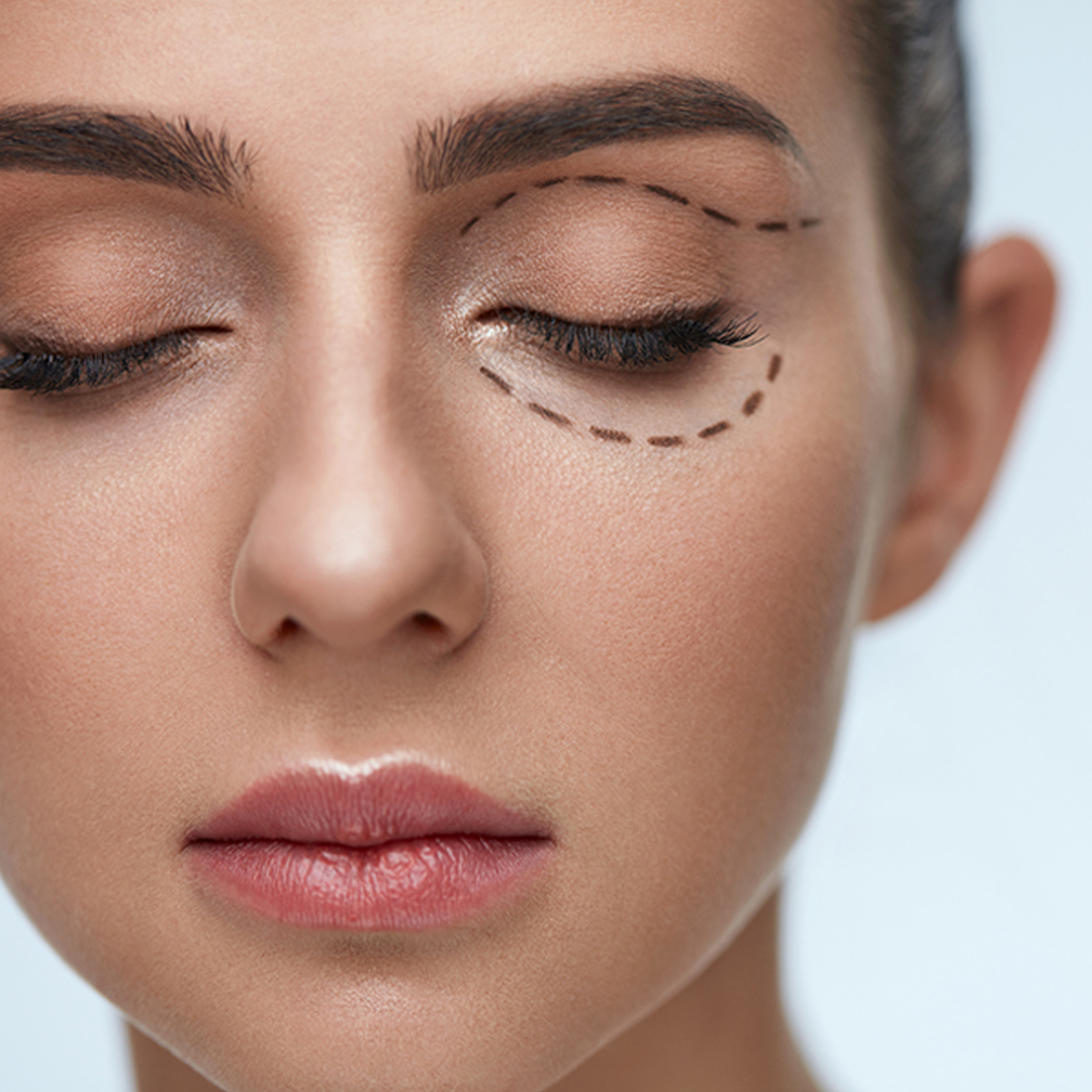 Eyelid Aesthetic 