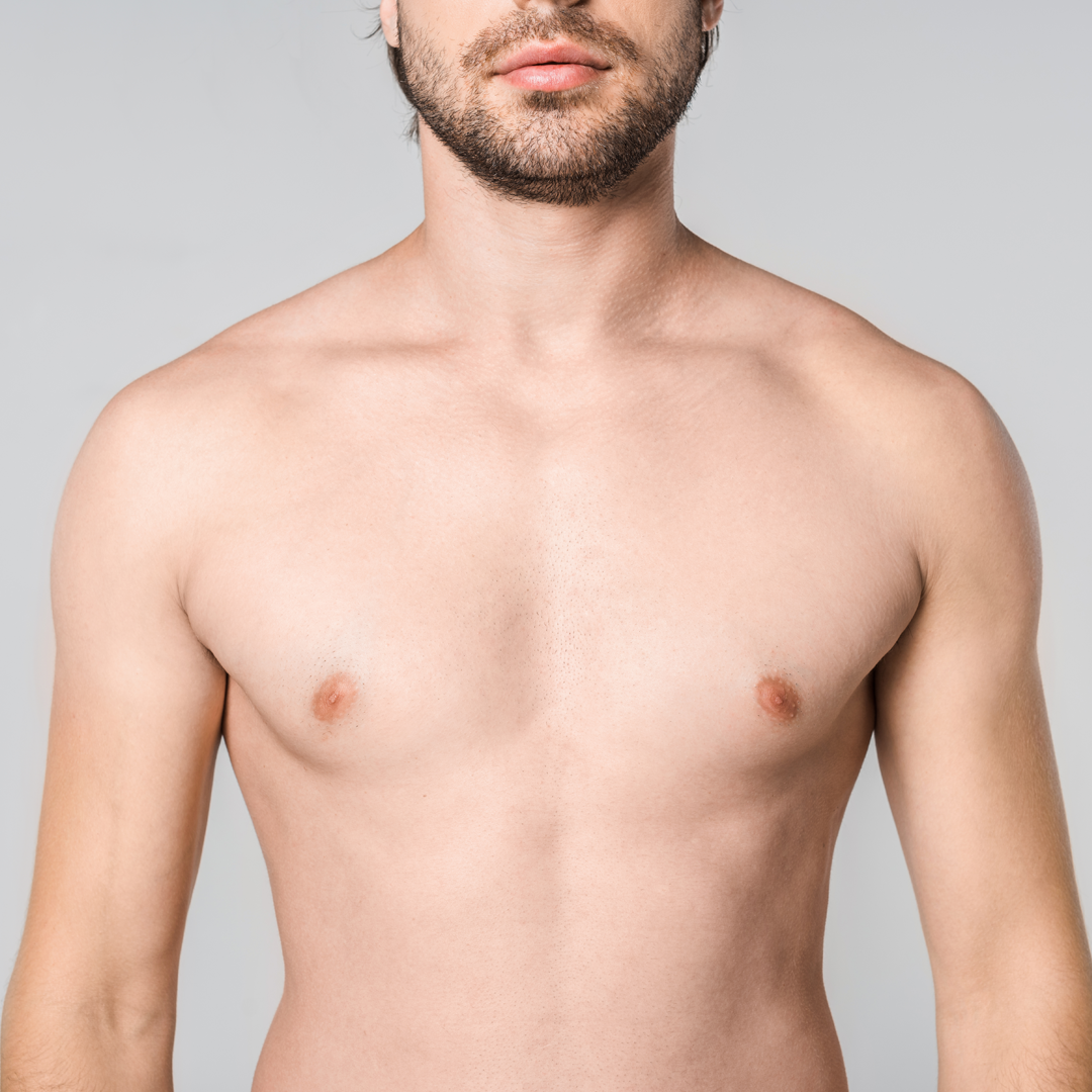 Gynecomastia  Men