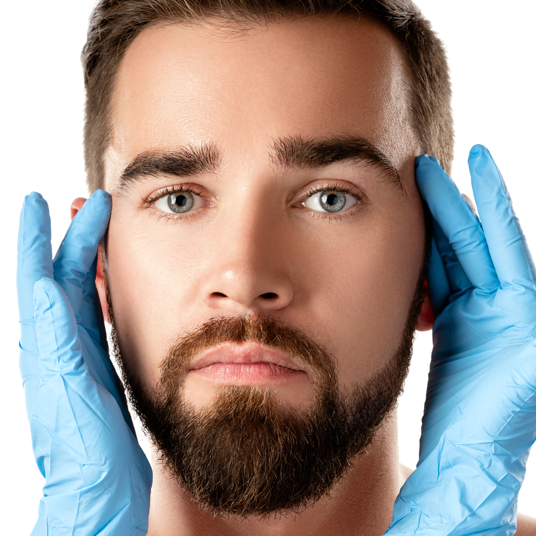 Beard Transplant